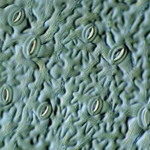 LM of the surface of an elder leaf