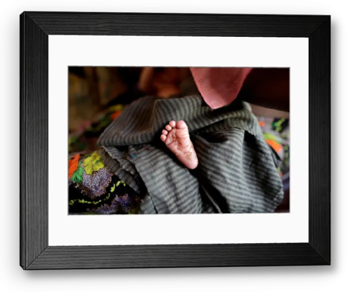 Framed Print : A foot of the new born Rohingya baby is pictured at a medical center in Kutupalong Framed Print : A foot of the new born Rohingya baby is pictured at a medical center in Kutupalong