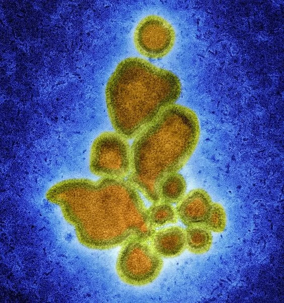 Avian influenza virus, TEM C016  /  2352