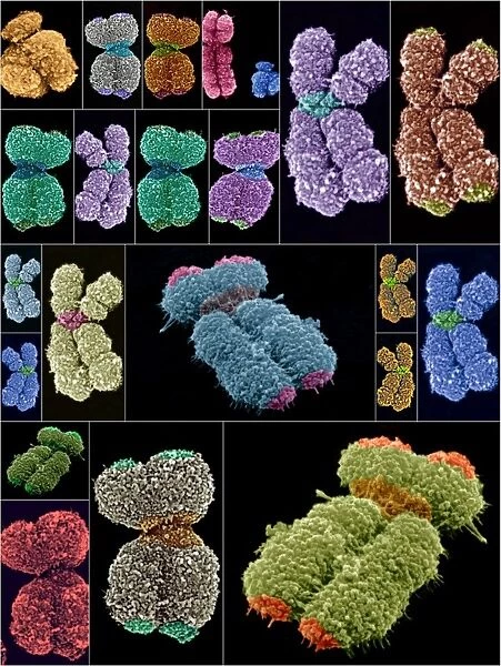 Human chromosomes, SEMs