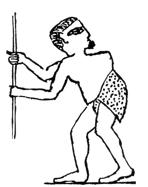 Potts disease in Egyptian tomb drawing