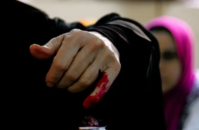 Framed Print : An Egyptian woman has her finger stained with ink after casting her vote during the first
