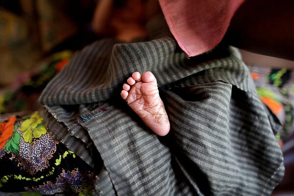 A foot of the new born Rohingya baby is pictured at a medical center in Kutupalong