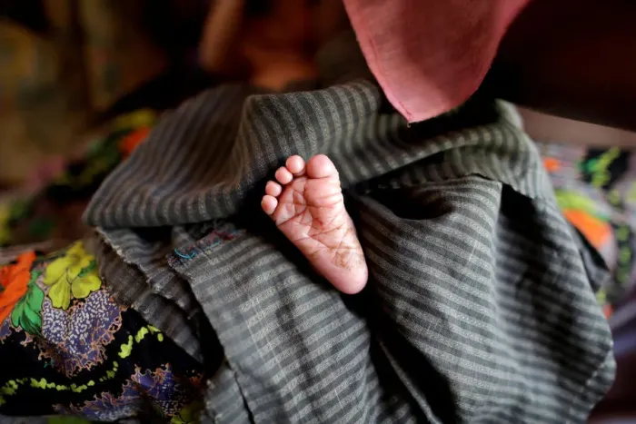 Framed Print : A foot of the new born Rohingya baby is pictured at a medical center in Kutupalong Framed Print : A foot of the new born Rohingya baby is pictured at a medical center in Kutupalong