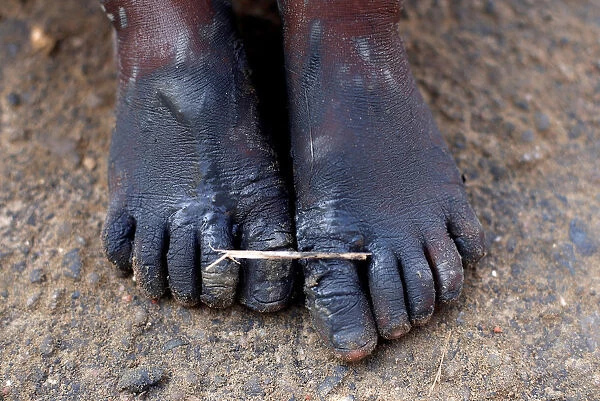 A Rohingya refugee boys feet are covered with mud after crossing the Bangladesh-Myanmar