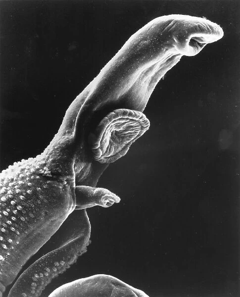 Scanning electron micrograph of a schistosome parasite