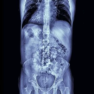 Human torso, MRI scan
