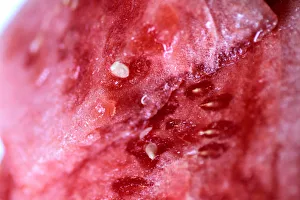 Illustration photo of a watermelon